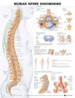 Human Spine Disorders Anatomical Anatomy Laminated Chart Poster