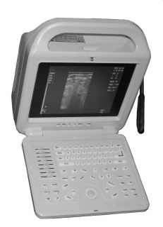   Laptop Ultrasound scanner 12screen& Rectal probe 5 10Mhz  low price