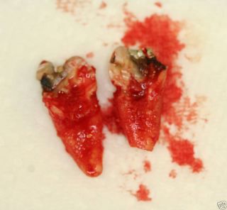 Extraction Guide for The Exodontist by Dr Tommy Murph