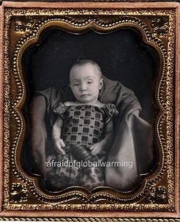 Photo. 1851. Postmortem Small Infant Girl