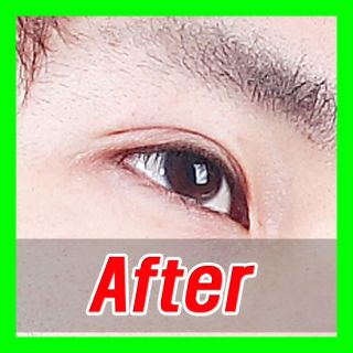 It’s innovatively double sided eyelid tape (132pcs)*4
